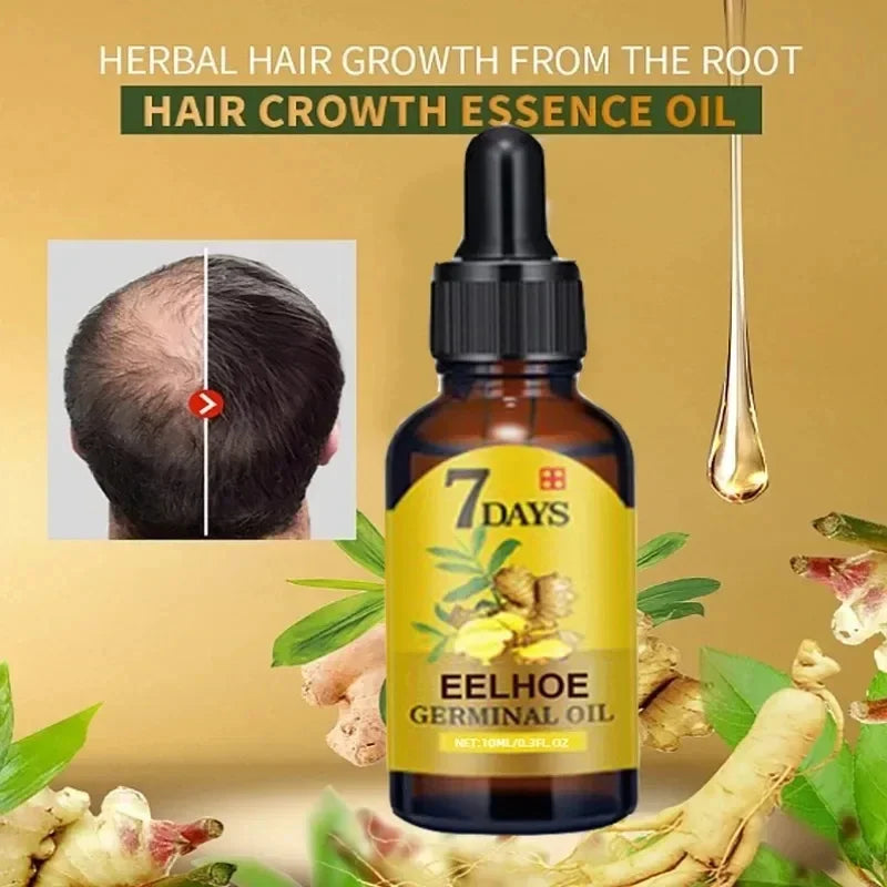 Fast Hair Growth Oil: Ginger Treatment for Men and Women.